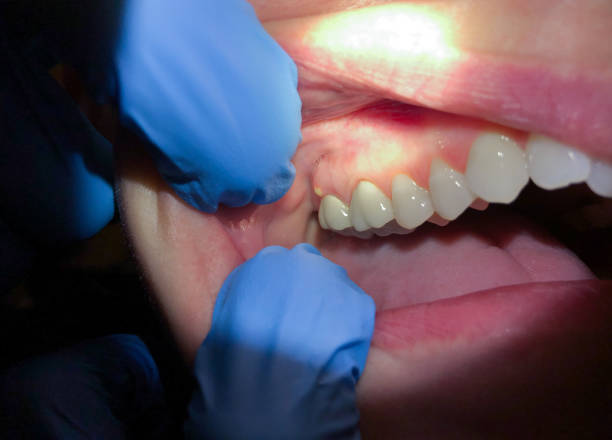 Best Emergency Dental Services for Seniors in Cumberland, MD