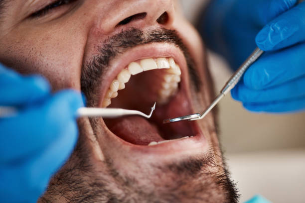 Best Orthodontic Emergency Dentist in Cumberland, MD